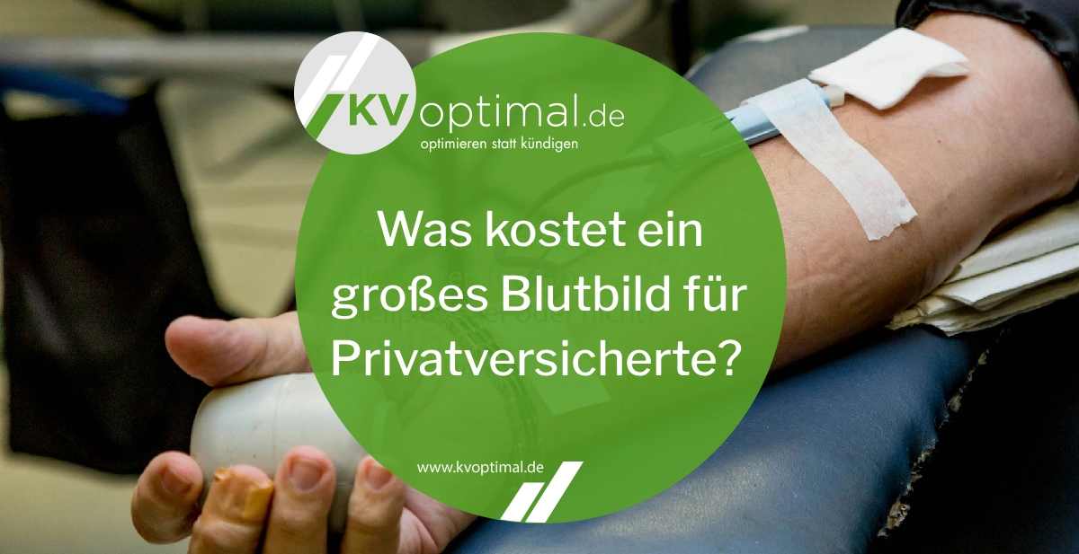 Wie viel kostet ein großes Blutbild für Privatversicherte?